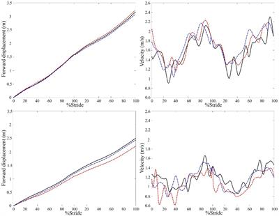 Walking performance of persons with chronic stroke changed when looking down but not in dimly lit environment